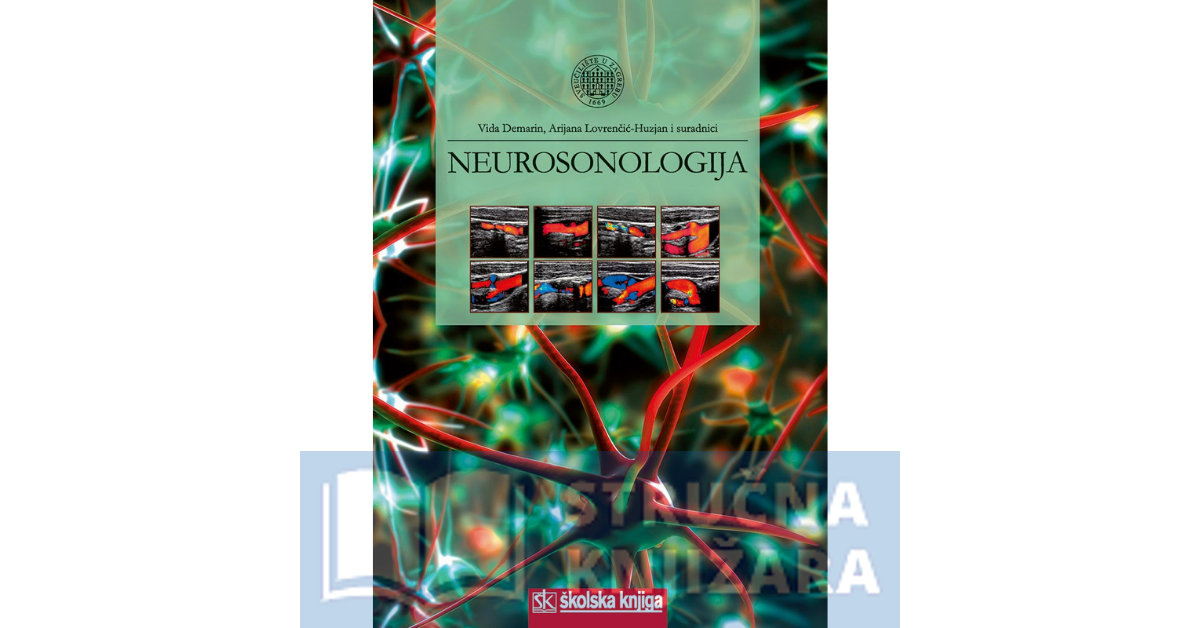 Neurosonologija - Vida Demarin, Arijana Lovrenčić-Huzjan i suradnici