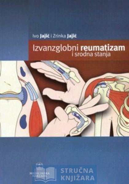 Izvanzglobni reumatizam i srodna stanja - Ivo Jajić i Zrinka Jajić