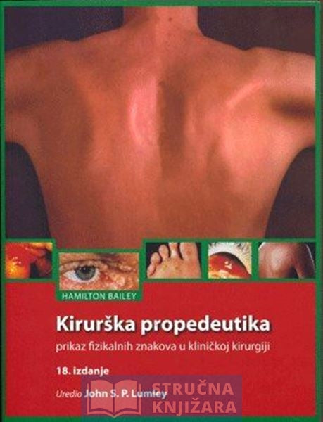 Kirurška propedeutika - prikaz fizikalnih znakova u kliničkoj kirurgiji - Hamilton Bailey