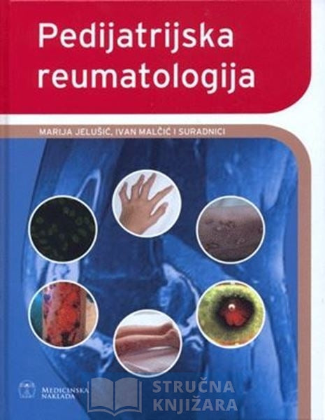 PEDIJATRIJSKA REUMATOLOGIJA - Ivan Malčić Marija Jelušić