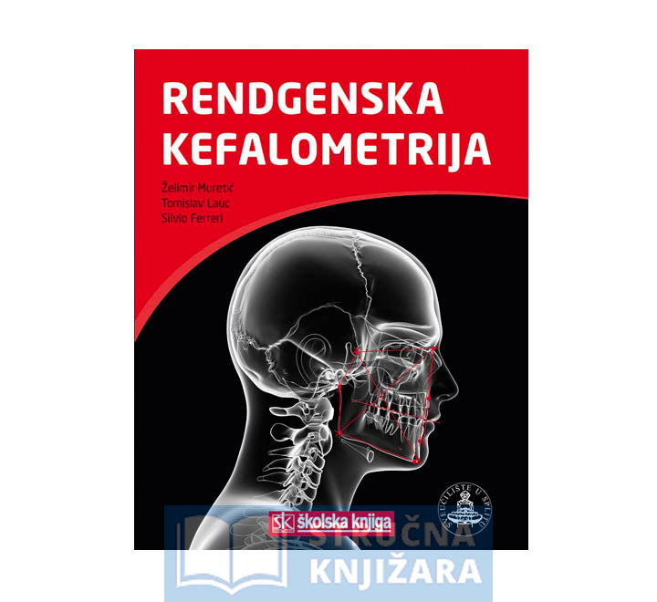 Rendgenska kefalometrija - Želimir Muretić, Tomislav Lauc, Silvio Ferreri