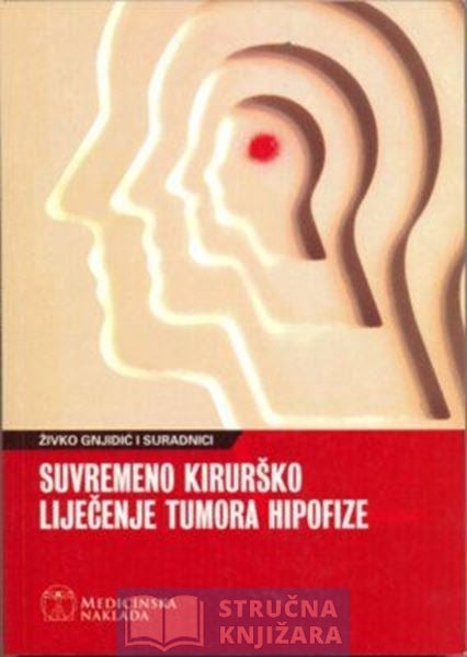 Suvremeno kirurško liječenje tumora hipofize - Živko Gnjidić i suradnici