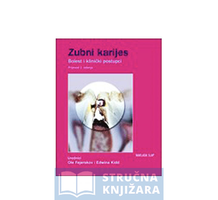 Zubni karijes - Bolesti i klinički postupci - Urednik: Ivica Anić