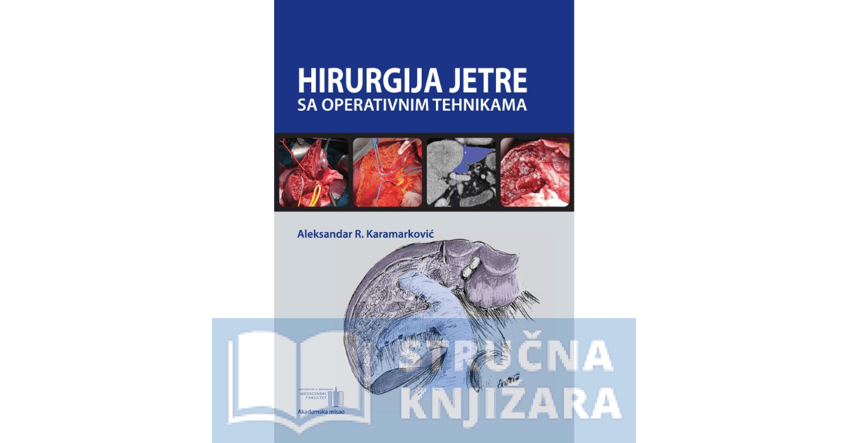 Hirurgija jetre sa operativnim tehnikama - Kirurgija jetre sa operativnim tehnikama - Aleksandar Karamarković