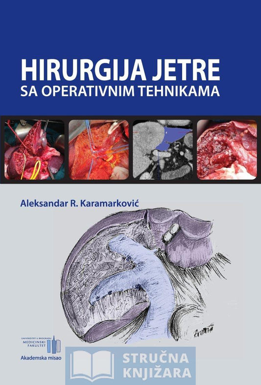 Hirurgija jetre sa operativnim tehnikama - Kirurgija jetre sa operativnim tehnikama - Aleksandar Karamarković