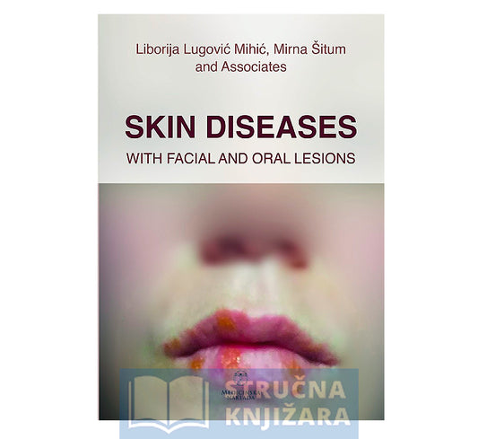 Skin diseases with facial and oral lesions - Liborija Lugović Mihić, Mirna Šitum i suradnici