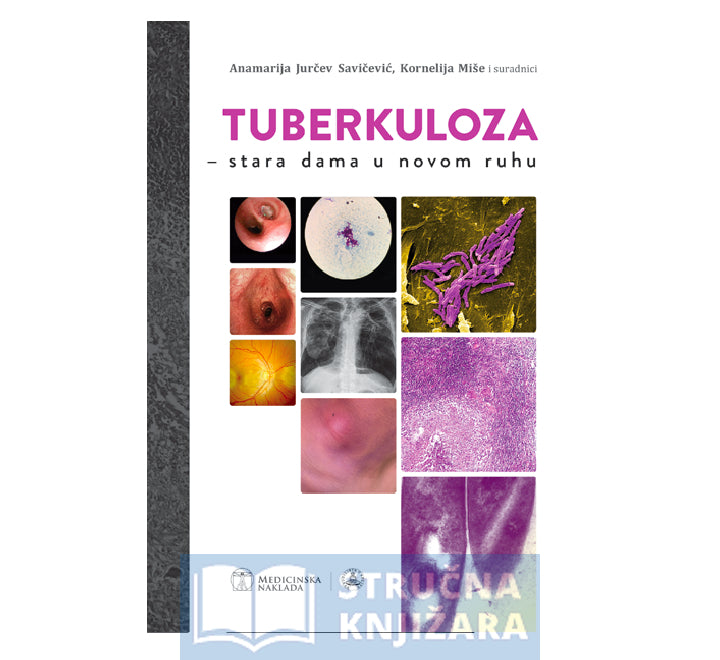 Tuberkuloza - stara dama u novom ruhu - Anamarija Jurčev Savičević, Kornelija Miše i suradnici
