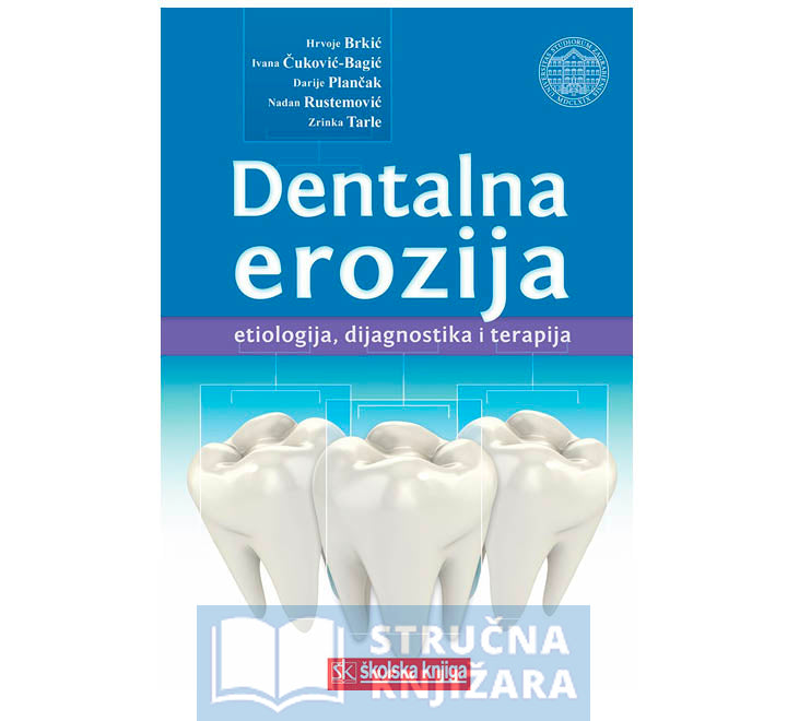 Dentalna erozija - Etiologija, dijagnostika i terapija - Hrvoje Brkić, Ivana Čuković-Bagić, Darije Plančak, Nadan Rustemović, Zrinka Tarle