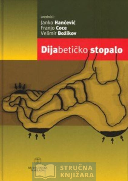 Dijabetičko stopalo - Janko Hančević, Franjo Coce, Velimir Božikov i suradnici