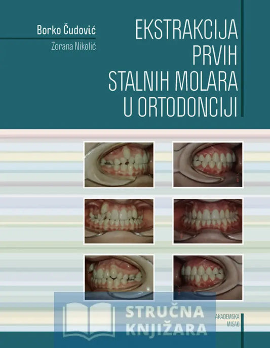 Ekstrakcija Prvih Stalnih Molara U Ortodonciji - Borko Čudović