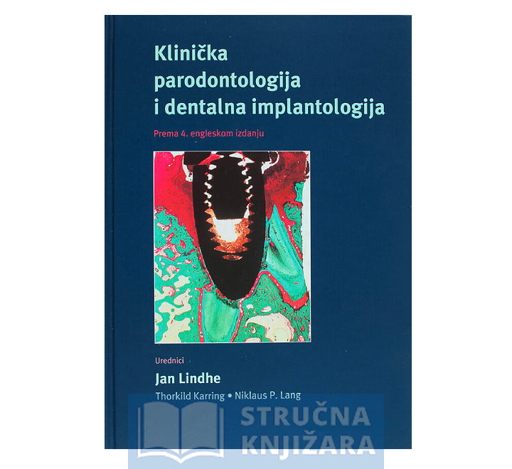 Klinička parodontologija i dentalna implantologija (IV. izdanje) - Jan Lindhe i suradnici