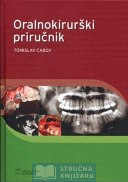 Oralnokirurški priručnik - Tomislav Ćabov