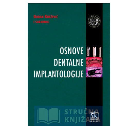Osnove dentalne implantologije - Goran Knežević i suradnici