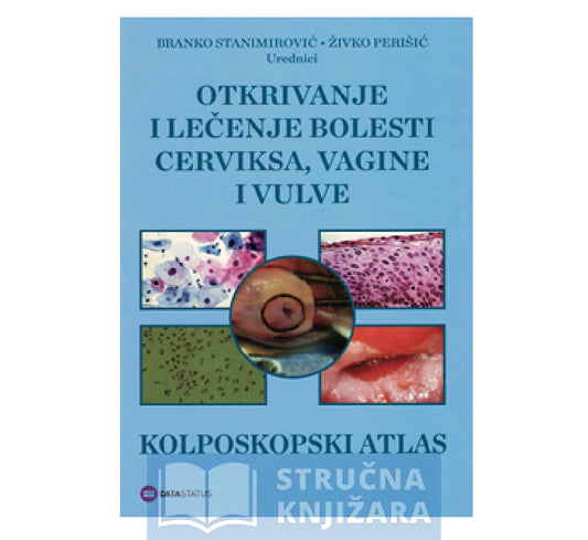 Otkrivanje i lečenje bolesti cerviksa, vagine i vulve - Kolposkopski atlas - Branko Stanimirović i Živko Perišić
