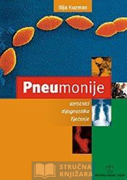 Pneumonije - uzročnici, dijagnostika, liječenje - Ilija Kuzman