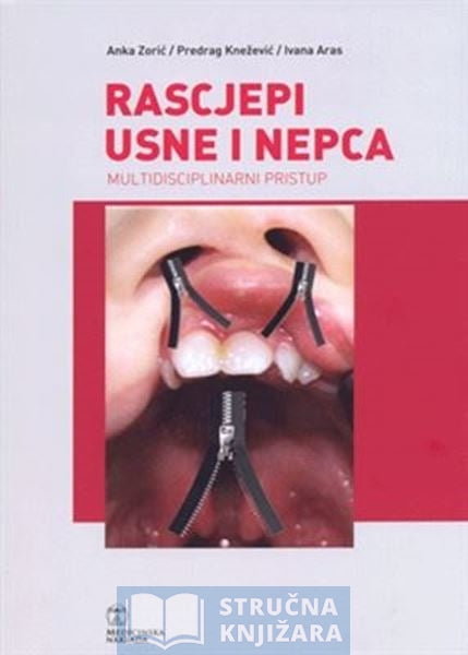 Rascjepi usne i nepca - autor: Anka Zorić,Predrag Knežević,Ivana Aras