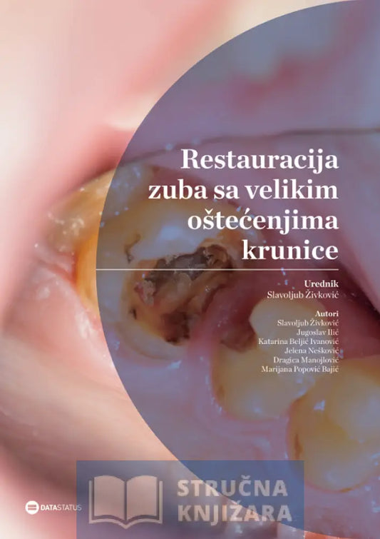 Restauracija Zuba Sa Velikim Oštećenjima Krunice - Slavoljub Živković